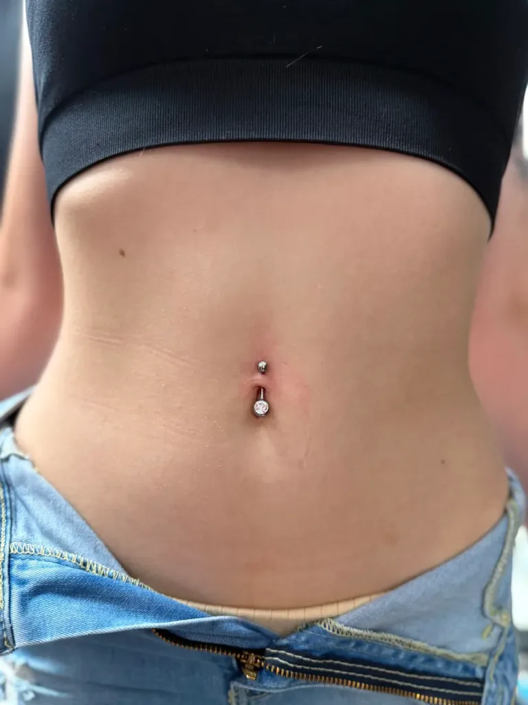 A healed navel piercing with a small titanium ball on top and a jewelled bezel stone below
